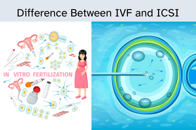 Difference Between IVF and ICSI.